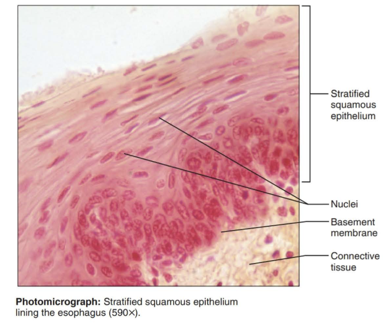 <p>Function: protects underlying tissues in areas subject to abrasion</p><p></p><p>Location: nonkeratinized type forms the moist lining of the esophagus, mouth, and vagina; keratinized type forms the epidermis of the skin, a dry membrane.</p>
