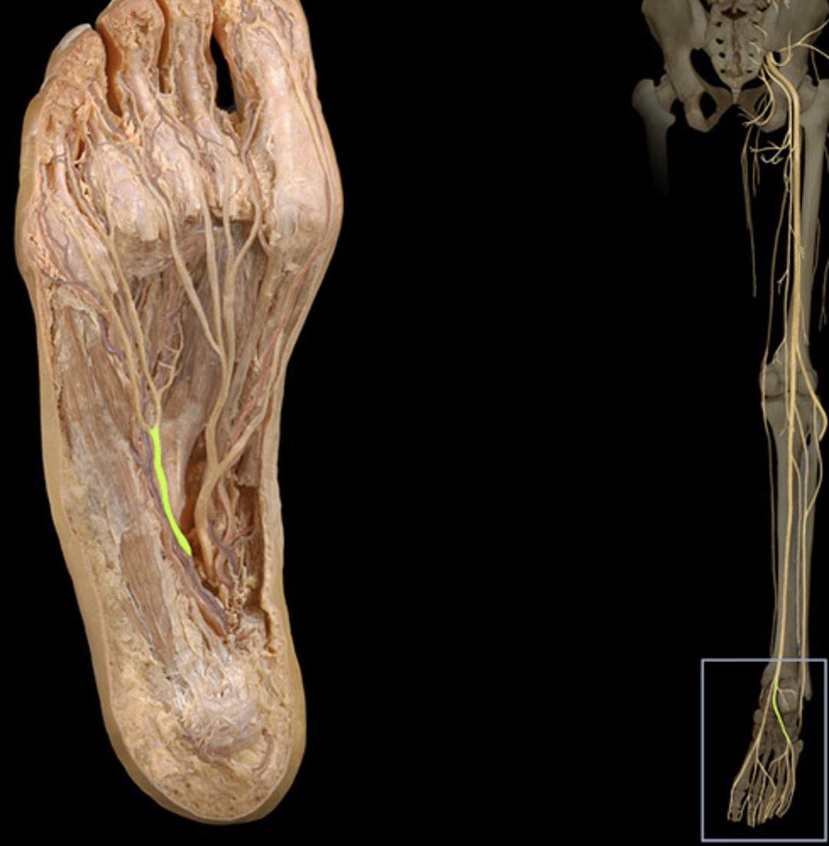 <p>Found under the abductor hallucis, then travels toward the 5th digit, which it innervates.</p>