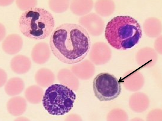 <p>Identify the labeled cell.</p>