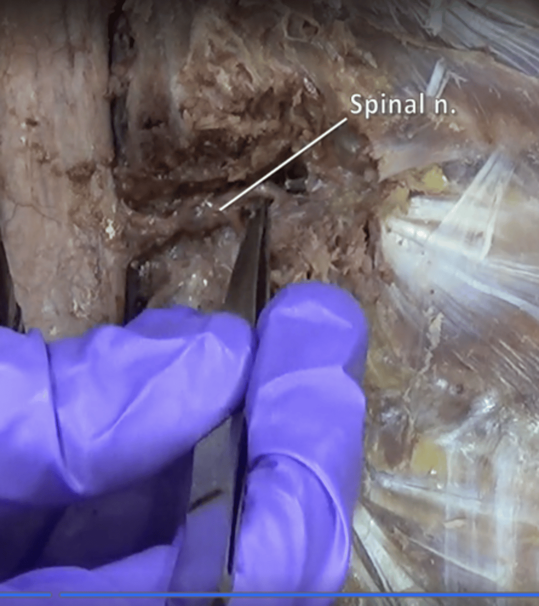 <p>31 pairs of nerves arising from the spinal cord</p>