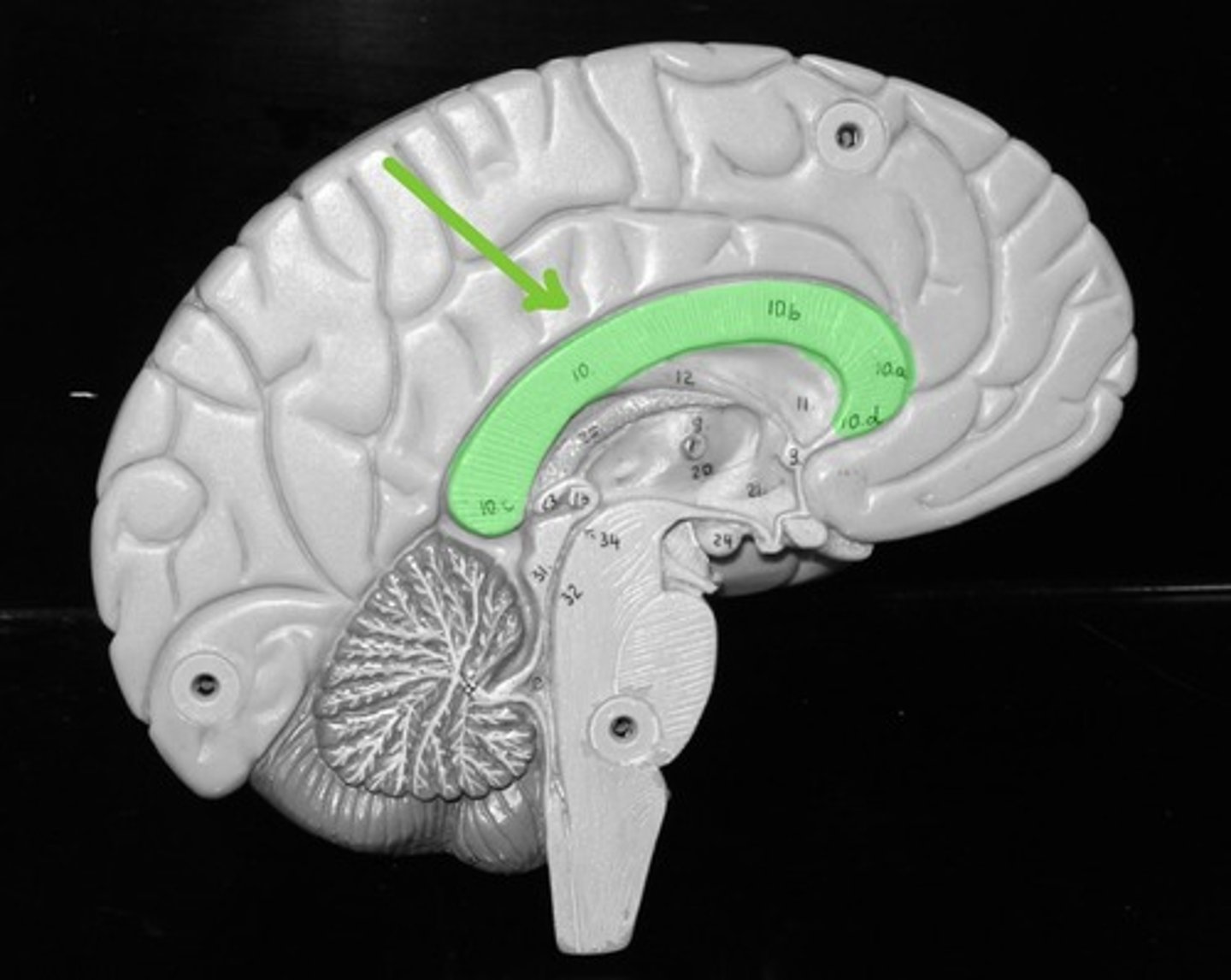 <p>Allows for communication between the left and right brain</p>