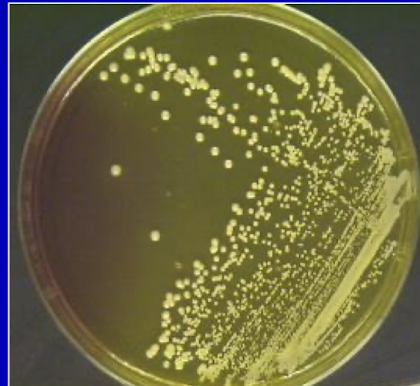 <p><strong><mark data-color="yellow" style="background-color: yellow; color: inherit;">MSA (mannitol salt agar) </mark>which has a high salt concentration which <em>S. aureus </em>is able to grow on, </strong>while inhibiting non-halotolerant bacteria</p><p><strong>Differentiates S. aureus through <mark data-color="yellow" style="background-color: yellow; color: inherit;">mannitol fermentation</mark>, producing <mark data-color="yellow" style="background-color: yellow; color: inherit;">yellow colonies</mark> as <u>phenol red is converted into a yellow colour</u></strong> due to acid production from mannitol fermentation</p>