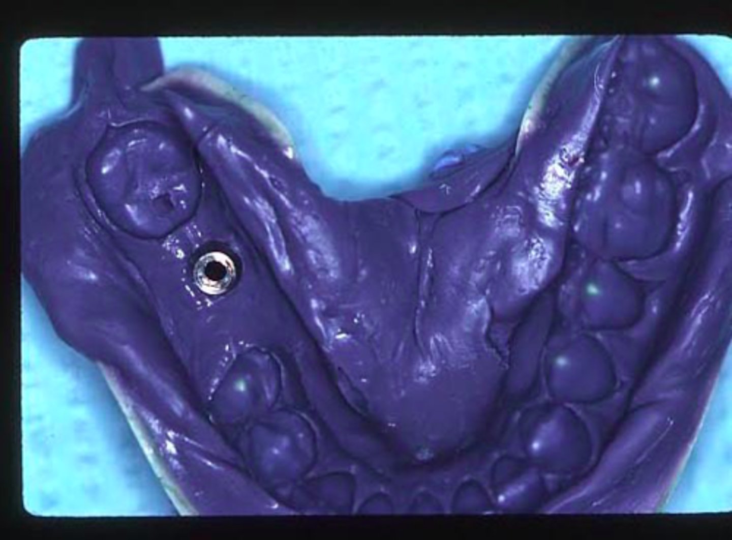 <p>ID the technique:</p>