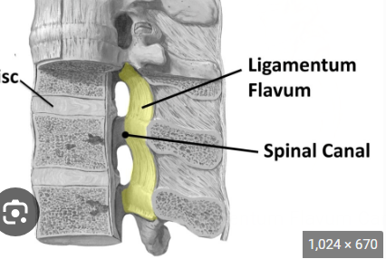 <p>Q. What is the ligamentum flavum?</p>