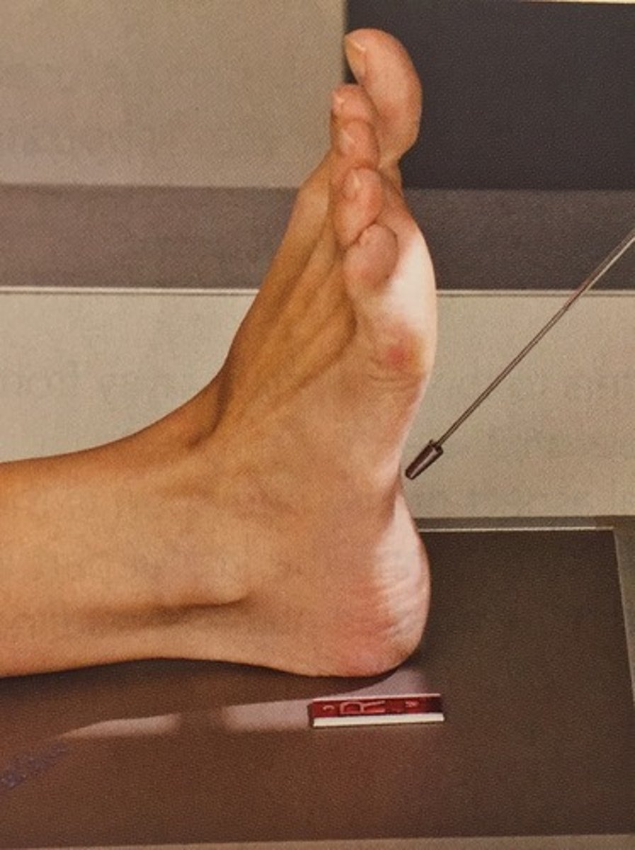 <p>A special plantodorsal projection of the heel bone (calcaneous) axial plantodorsal projection (PD) because the angled CR enters the plantar surface of the foot and exits the dorsal surface.</p>