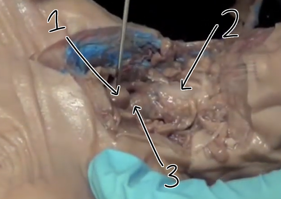 <p>What is 1? Purpose?</p>