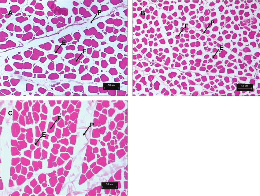 <p>A thin layer of connective tissue that surrounds individual muscle fibers.</p>