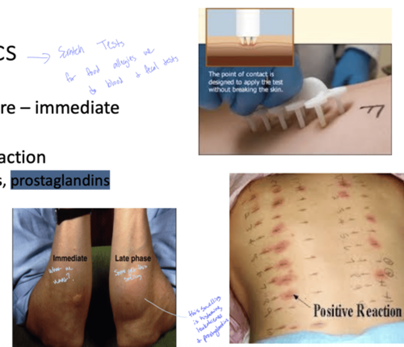 <p>A: Wheel and flare</p>