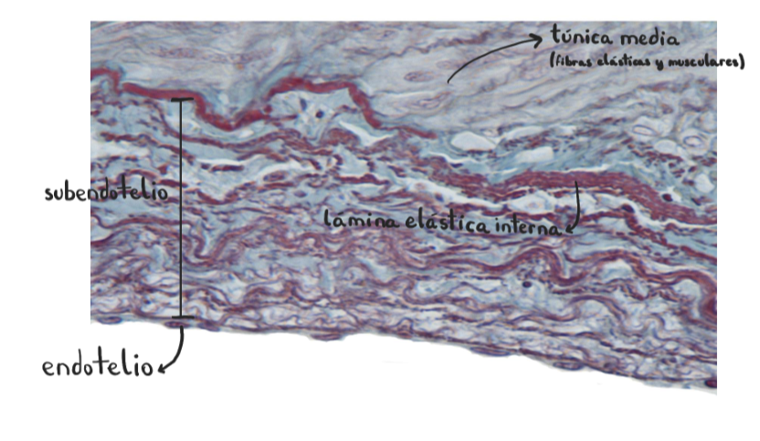 <p>Arteria coronaria (muscular)</p>