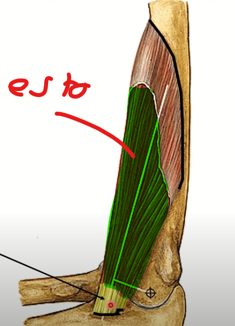 <p>Mayor capacidad de contractilidad</p><p>Puede haber uno más</p>