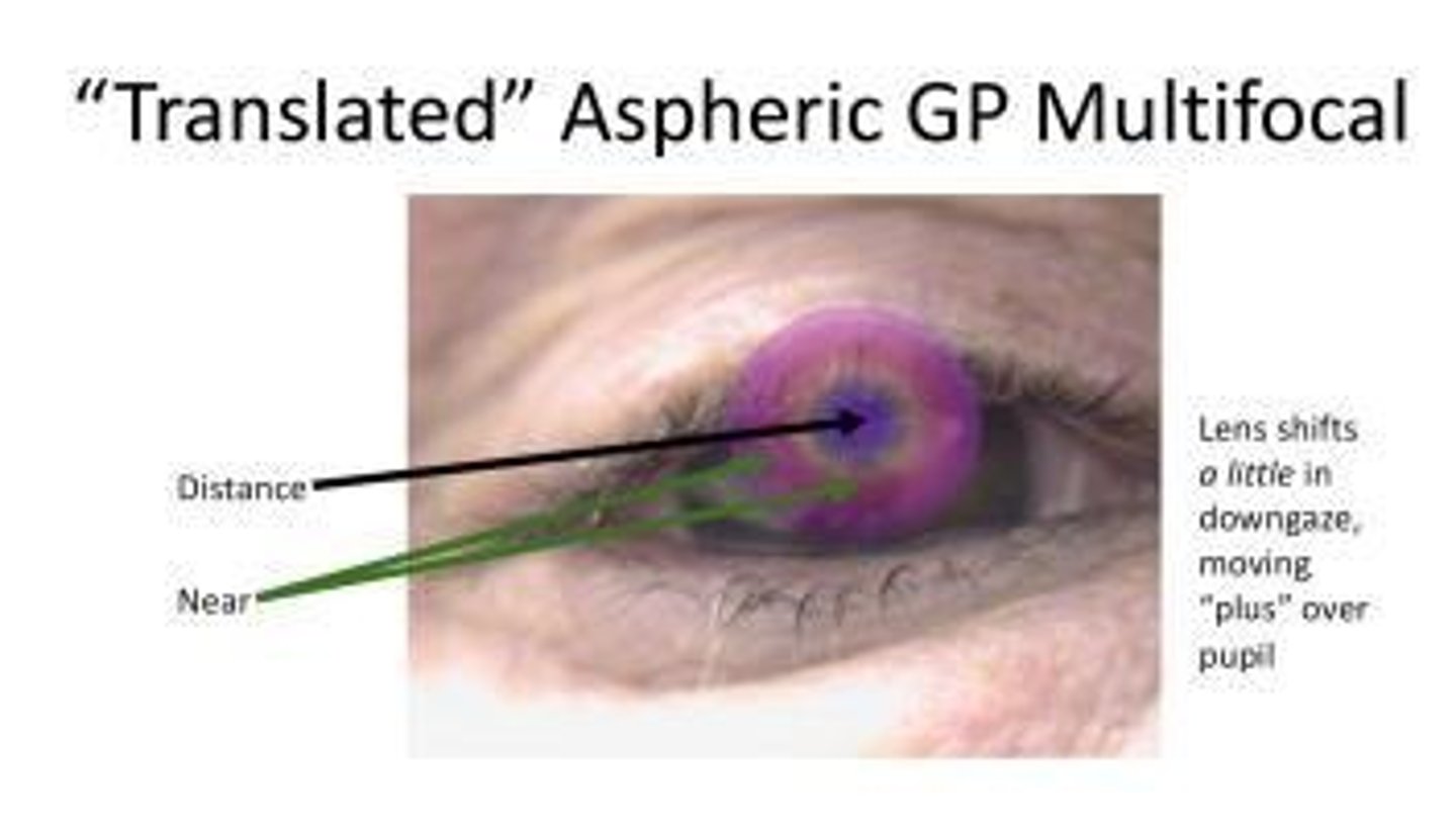 <p>A method where one eye is corrected for distance and the other for near vision.</p>