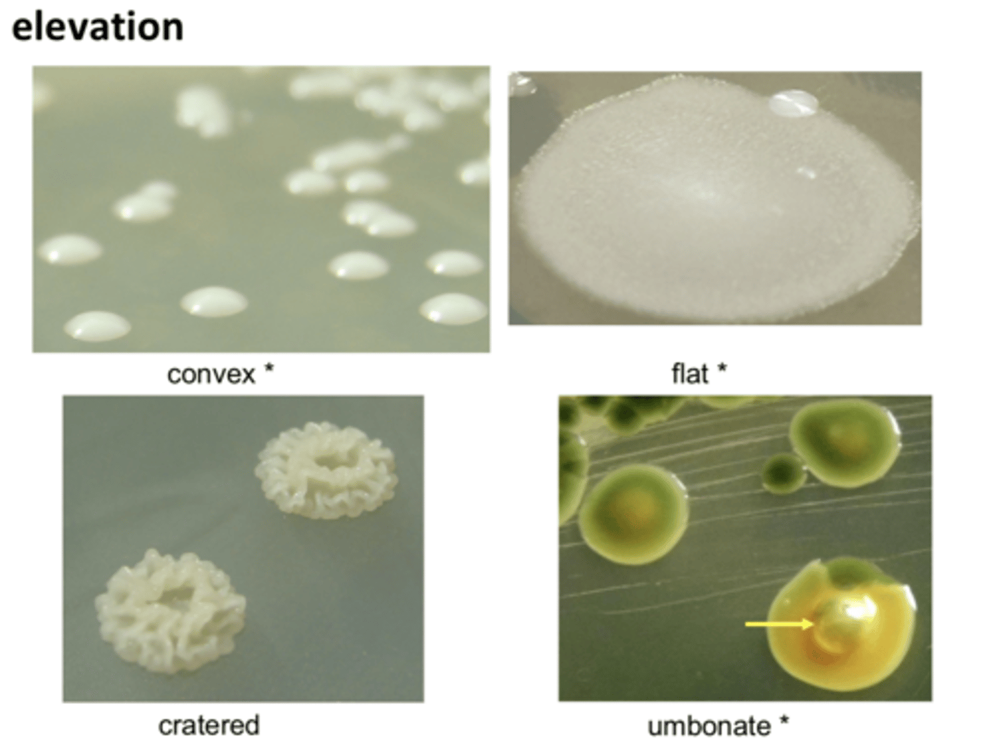 <p>convex, flat, cratered, umbonate</p>