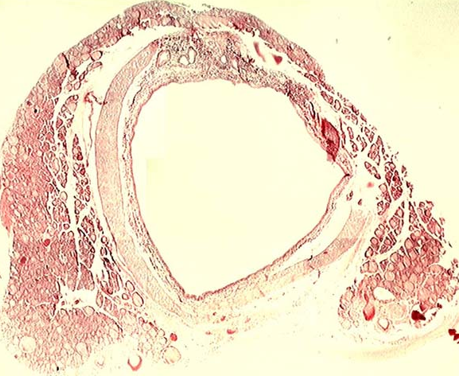 <p>Trachea due to the c-shaped cartilage ring</p>