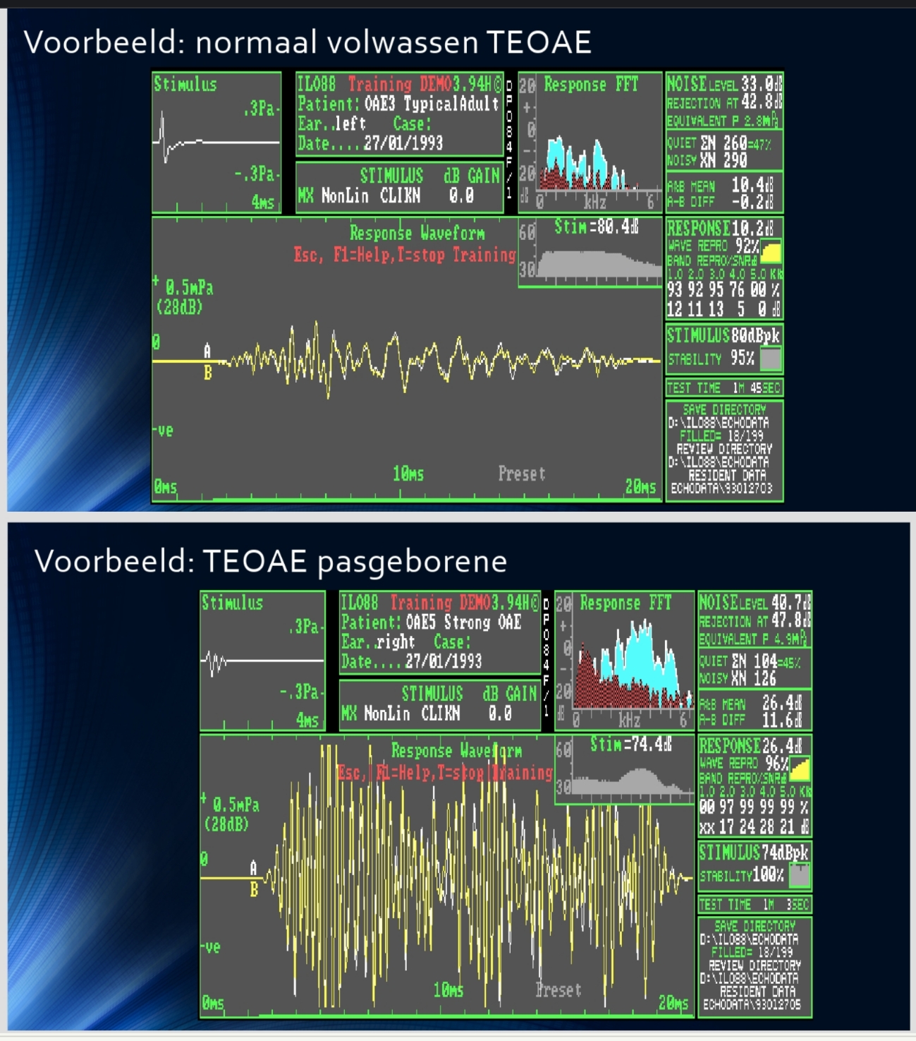 <p>response 10.2dB vs 26.4dB → beide normaal</p><p>→ emissies bij babys veel krachtiger WIL NIET zeggen dat hij beter hoort</p><p>→ is door kleinere gehoorgang = grotere druk = luider  (groeit tot 12j)</p>