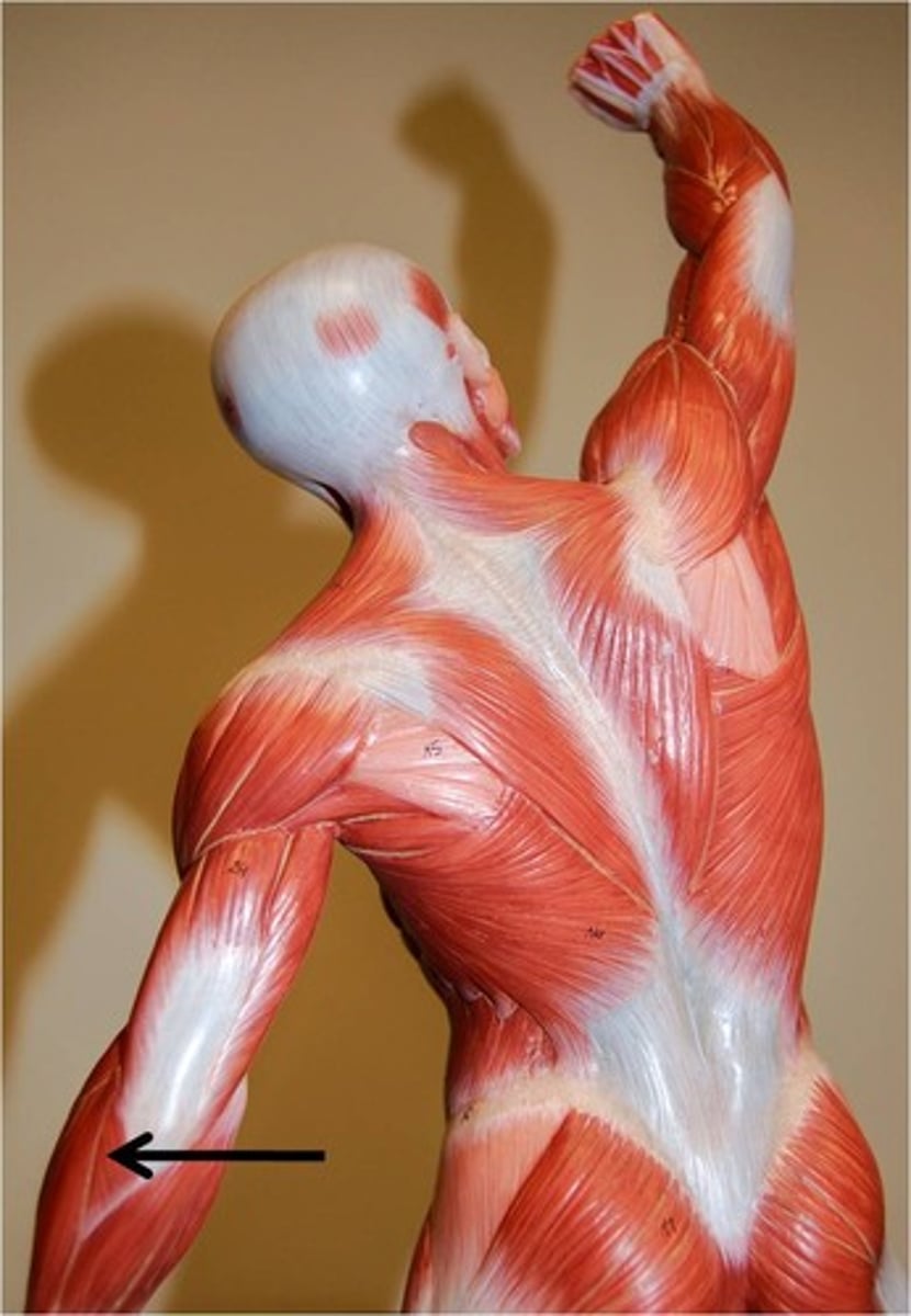 <p>-Assists triceps in extending the forearm</p><p>-Radial n. (C5 - T1)</p><p>-Located in the posterolateral aspect of the elbow</p>