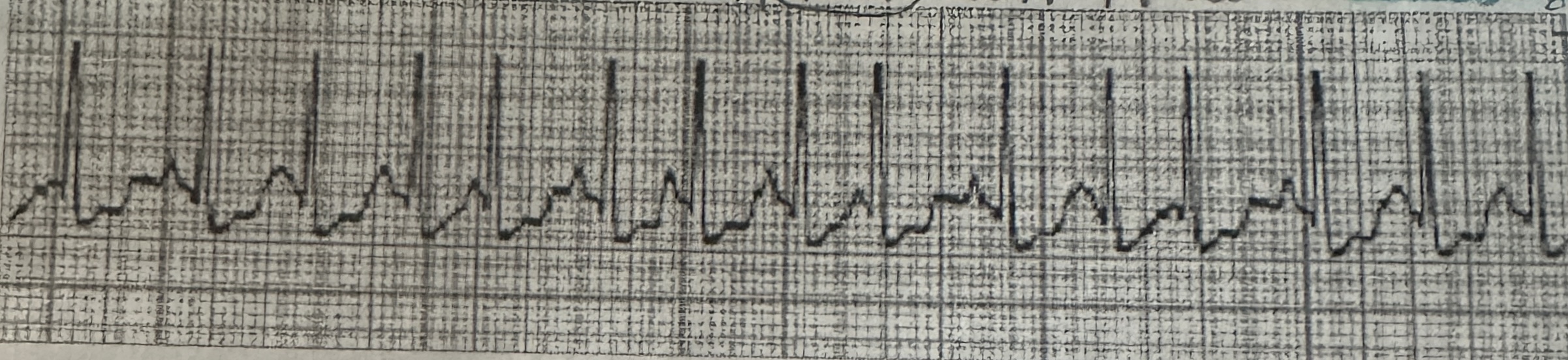 <p>The p waves in this strip…</p>