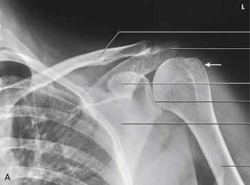 <p>What type of projection, position and anatomy is this?</p>