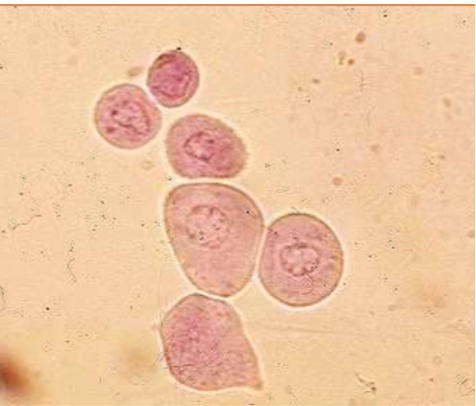 <p>These cells are present on sediment evaluation. What are they?</p>
