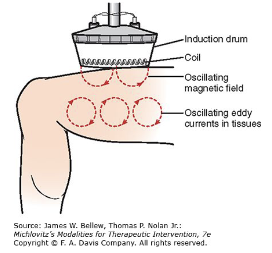 <p><span><span>Shortwave Diathermy Inductive Method requires an?</span></span></p>