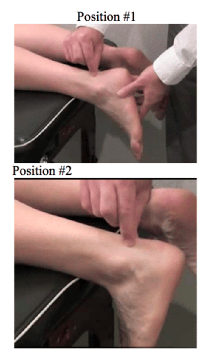 <p>Royal london hospital test (based on the case, we are hypothesizing Achilles tendinopathy)</p>