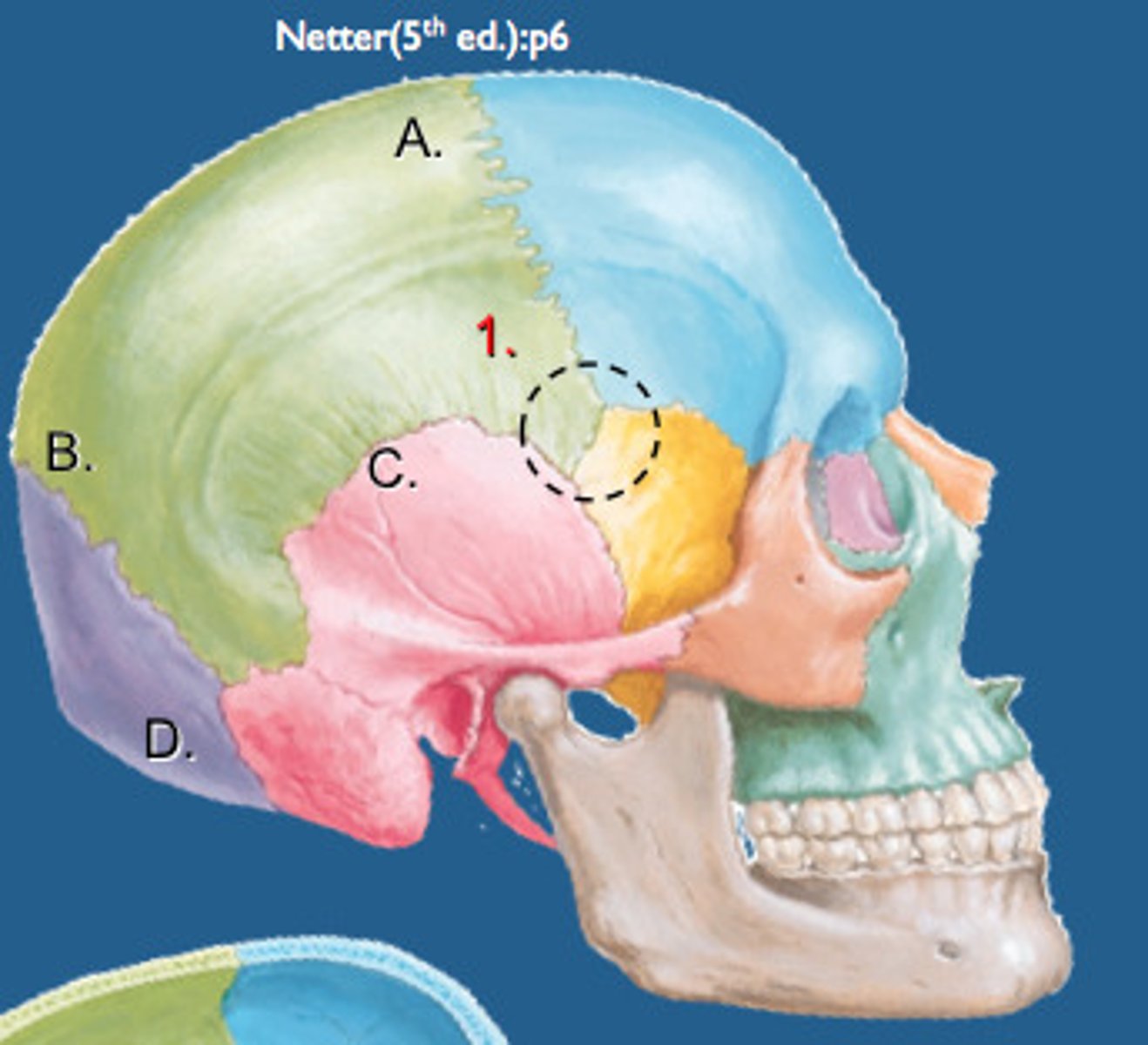 <p>the suture between all bones but occipital, weakest part of the skull</p>