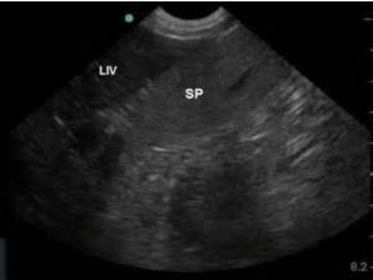 <ul><li><p>elliptical, flat, with smooth contours</p></li><li><p>more echogenic than liver</p></li><li><p>may see splenic sinusoids</p></li><li><p>Function:</p></li></ul><p>- stores RBC and produces RBC during fetal development</p><p>- filters the blood and lymph</p><p></p>
