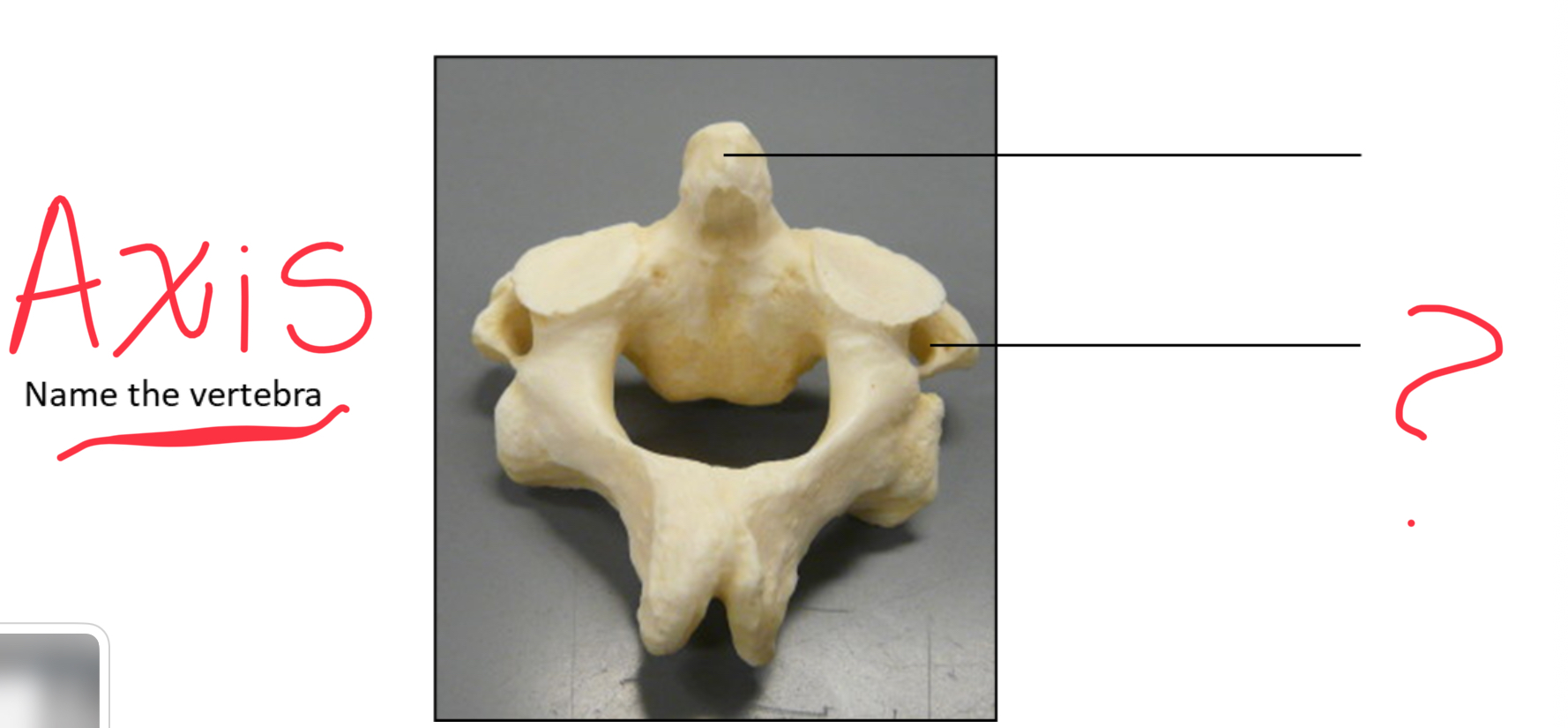 <p>Transverse foramen</p>
