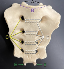 <p>Identify the structure labeled C. </p>