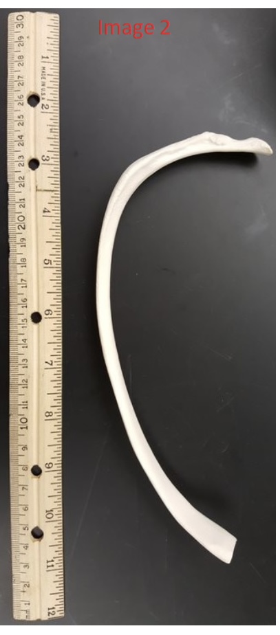 <p>5) name the bone in this image </p>