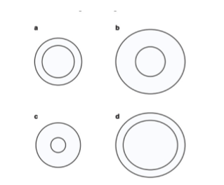 explain which ventricular geometry is associated with each type of training adaptation 