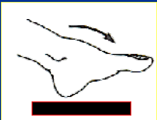 <p>What Movement is occurring?</p>