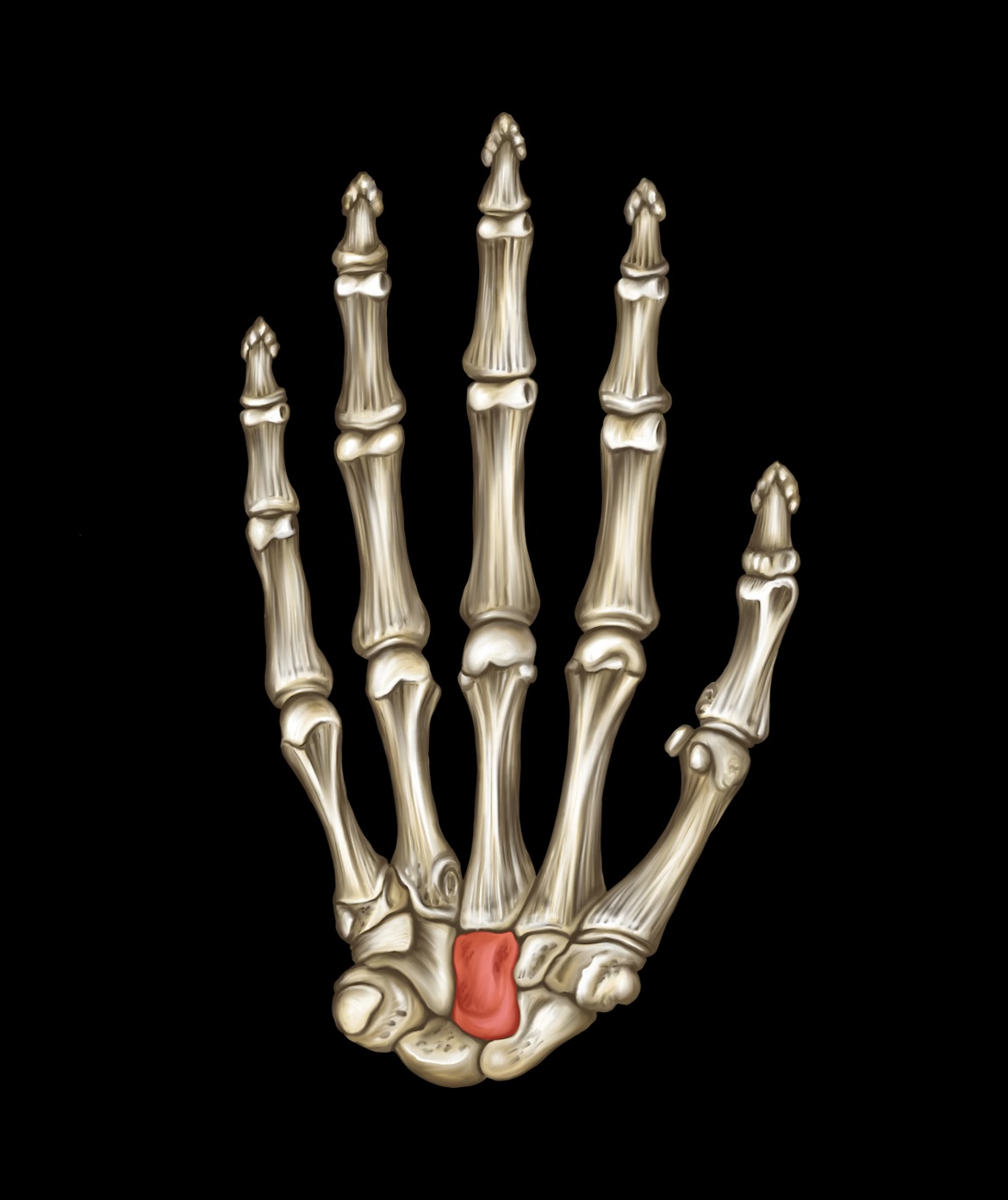 term image