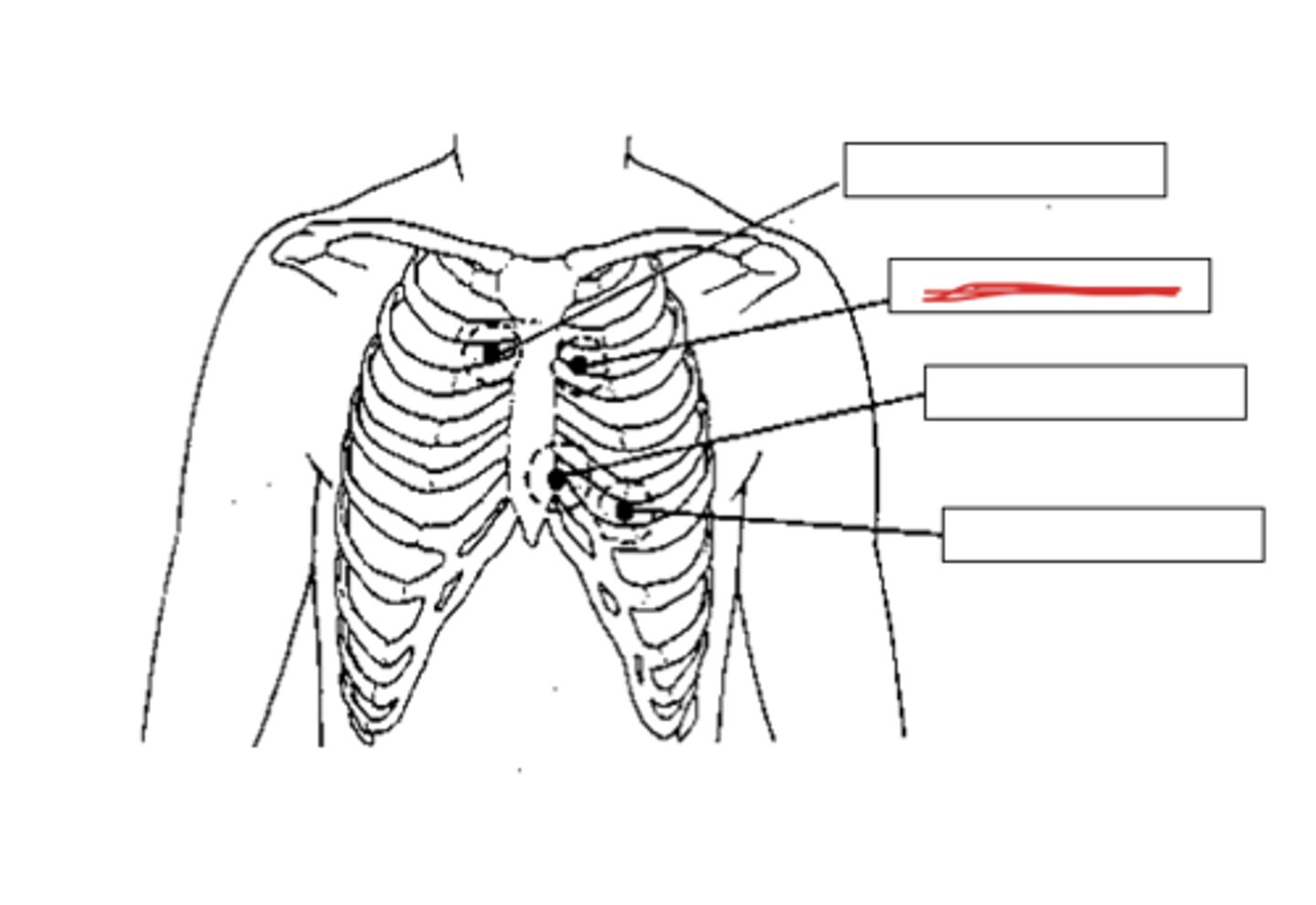 <p>at the second intercostal space (between ribs 2 &amp; 3) on the left sternal border</p>