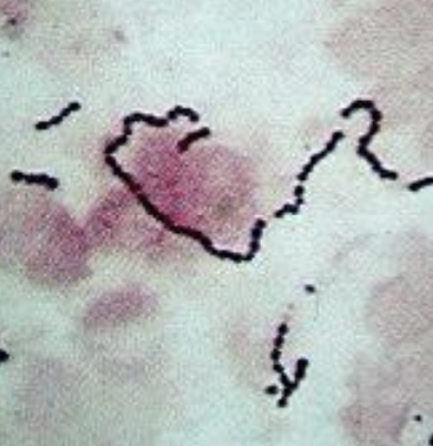 <p>What condition is also known as rain rot or rain scald, and is caused by Dermatophilus congolensis? It is a gram + bacteria that is branching, and is a type of actinomyces.</p>