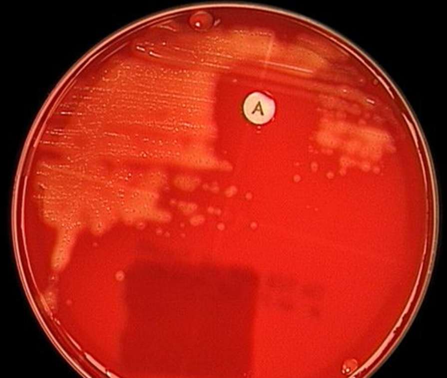 <p>What is the use of this test</p><p>What is the antibiotic disk?</p><p>What is the hemolysis activity?</p>