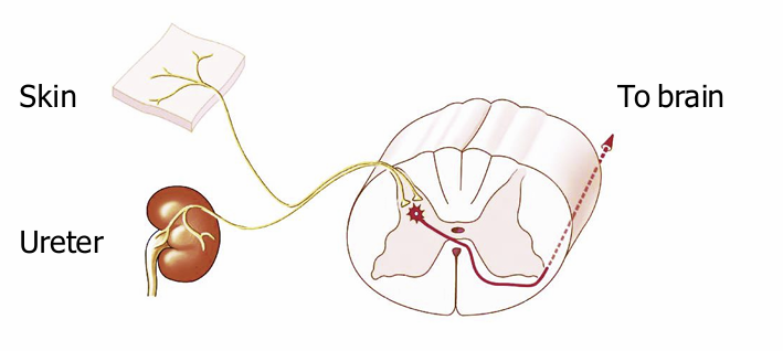<p>Pain in an internal organ is often felt on the body surface</p>