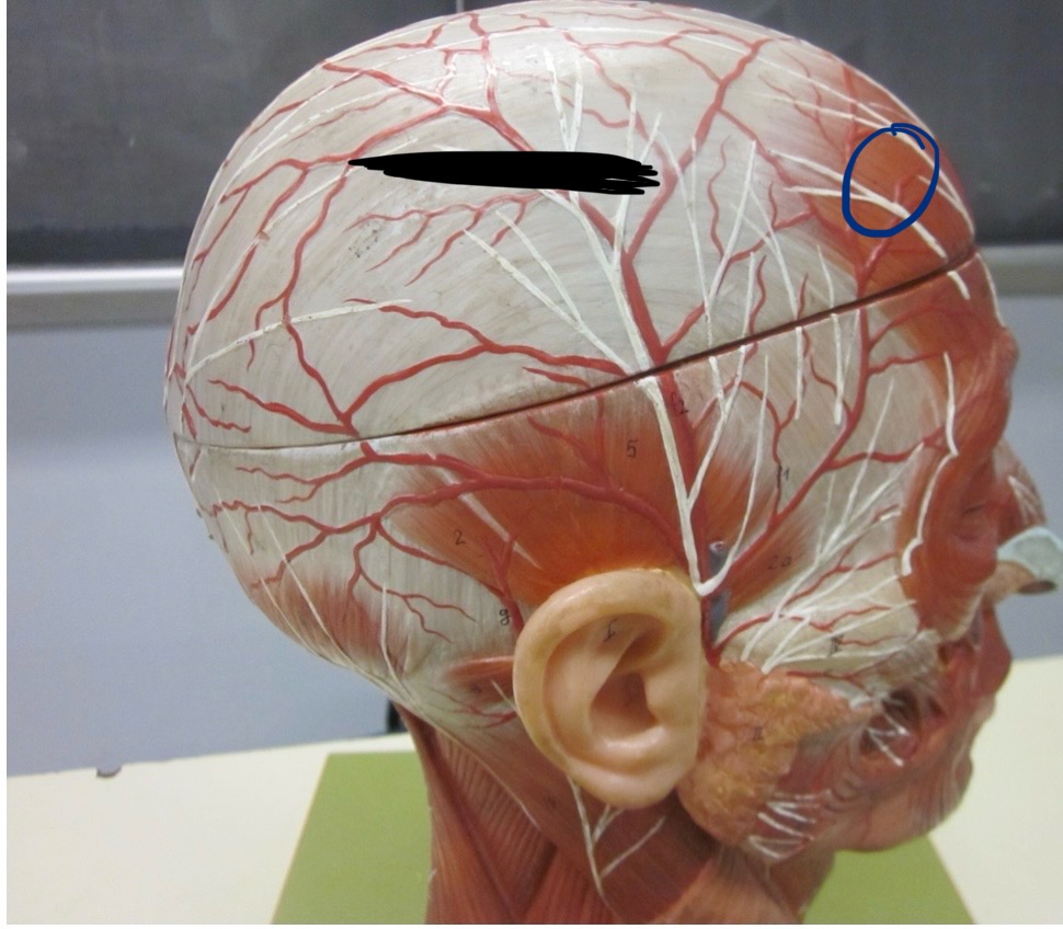 <p>Which muscle</p>