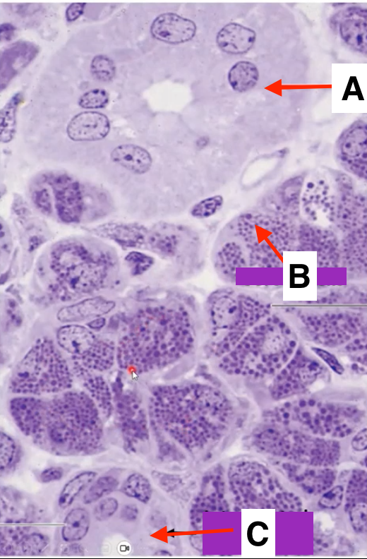 <p>what gland is this?</p>
