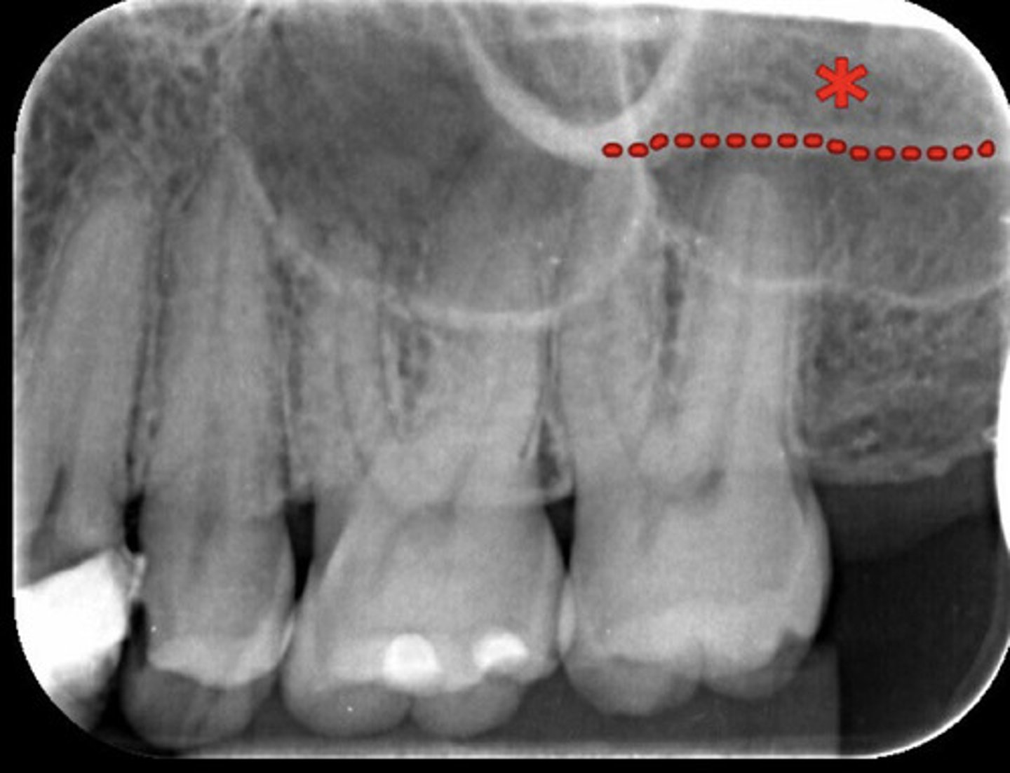 <p>What is the red dotted line representing?</p>
