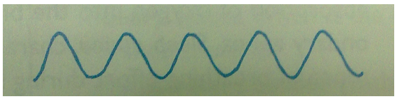 <p>Bradypnea</p><p><em>Hypokalemia, or decreased potassium, can lead to hypokalemic paralysis, which leads to weak muscles, including the respiratory muscles. This may present as bradypnea.</em></p><p><em>Hypothyroidism also leads to bradypnea in this same way.</em></p>