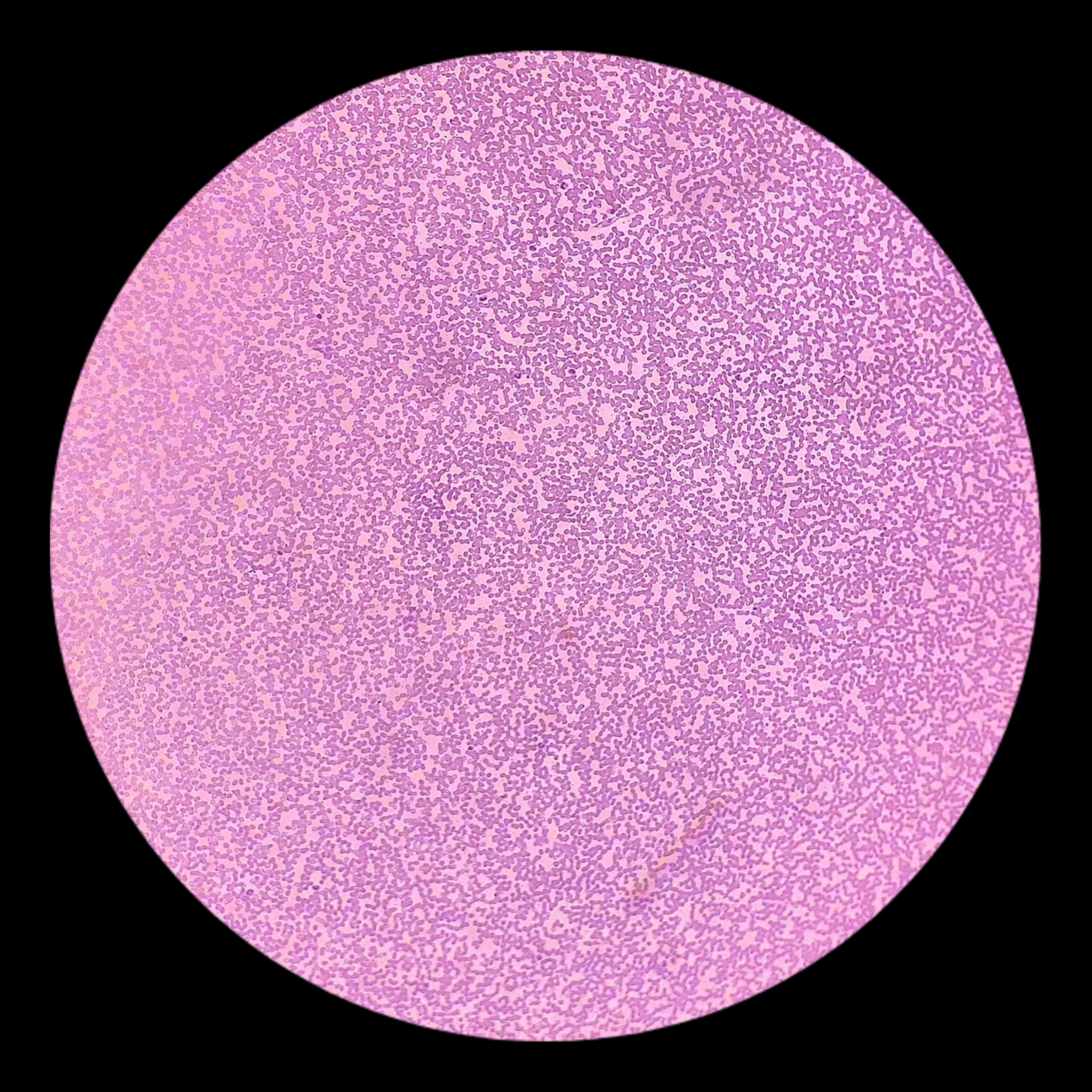 <p>Phylum of <em>Plasmodium malariae</em></p>