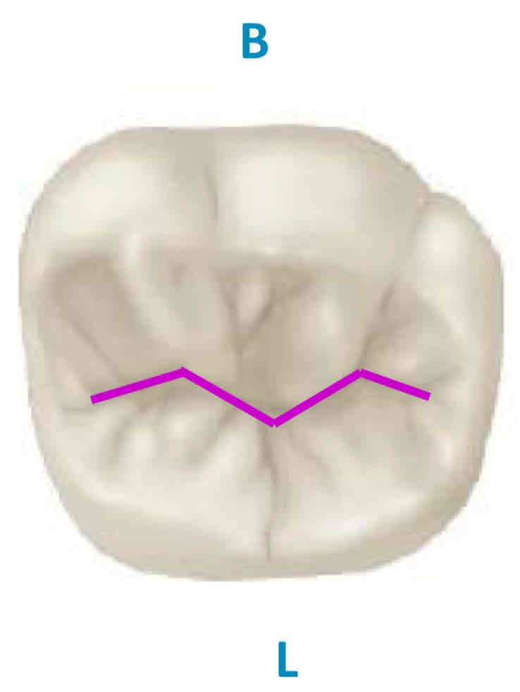 <p>what is the pattern of the central groove on occlusal surface of mandibular 1st molar</p><ul><li><p>has 3 fossae </p></li></ul>