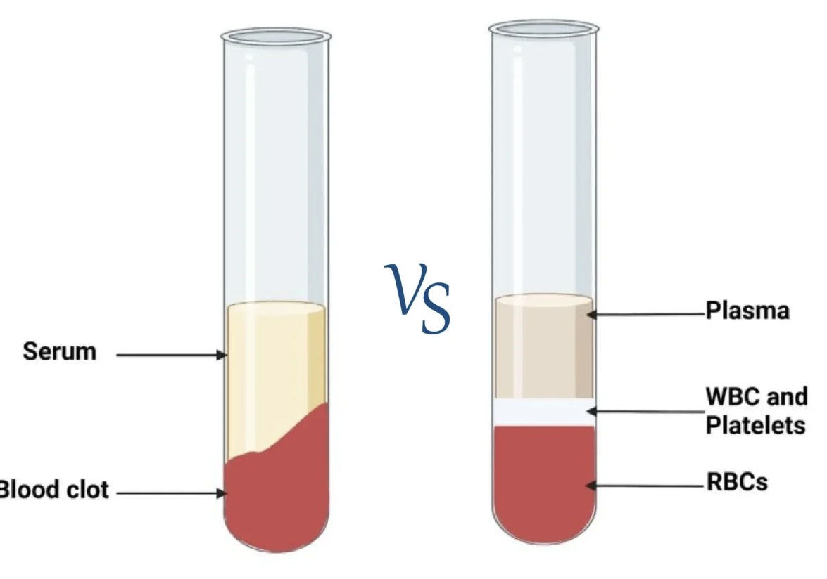 <p>What is <strong><u>plasma</u></strong> <strong> </strong>and how do we obtain it?</p>