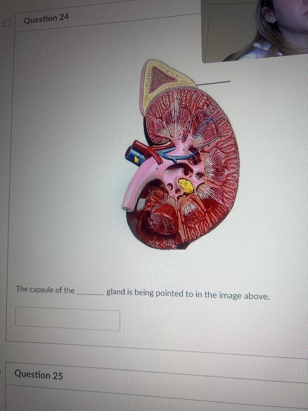 <p><span>The capsule of the BLANK gland is being pointed to in the image above.</span></p>