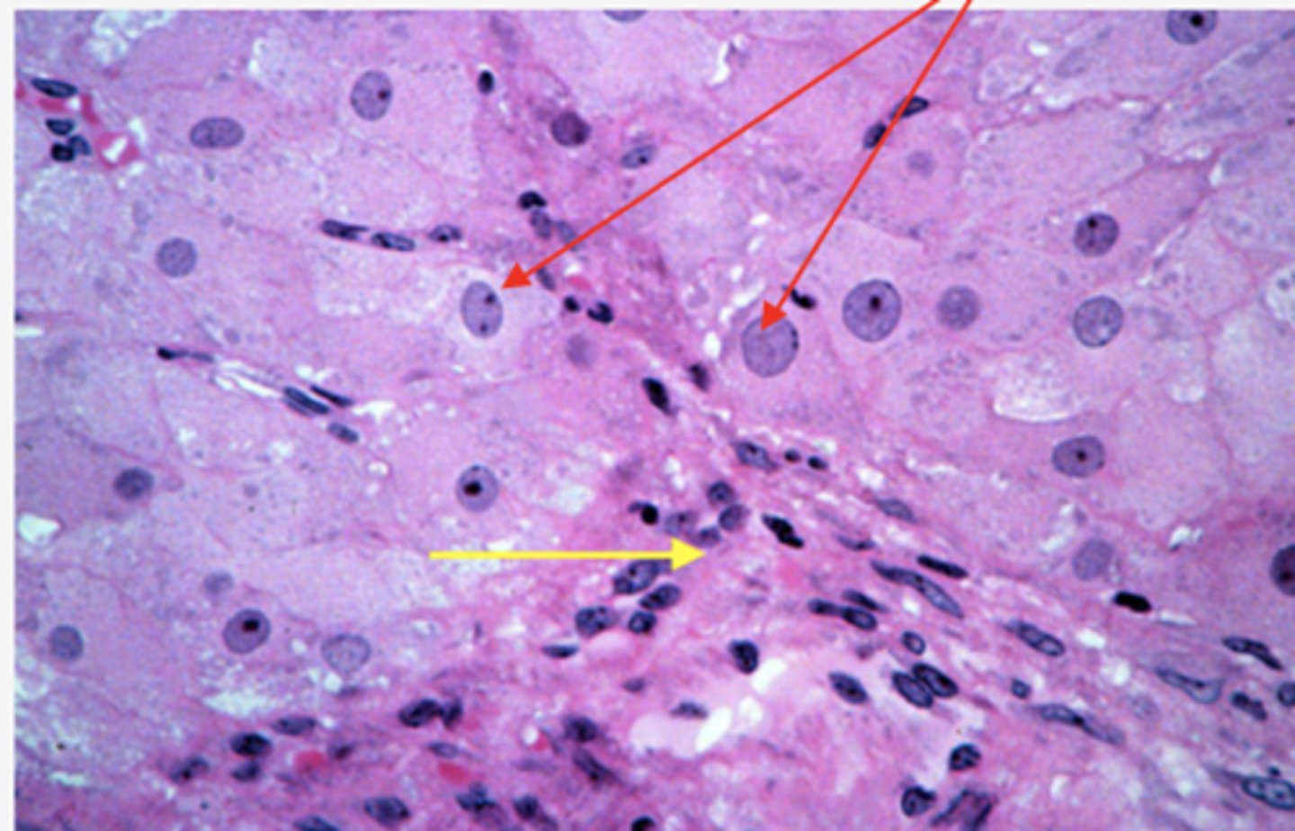 <p>Identify the cells (yellow arrow)</p>