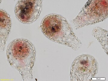 <p><strong>Phylum Rhizopoda (Amoebas)</strong></p>