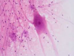 <p>Cell body of a neuron containing the nucleus.</p>