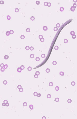 Filariae or threadworms