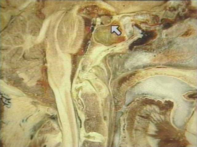 <p>What is depicted in this photo?</p>