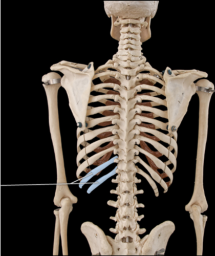 How would you classify the highlighted ribs?